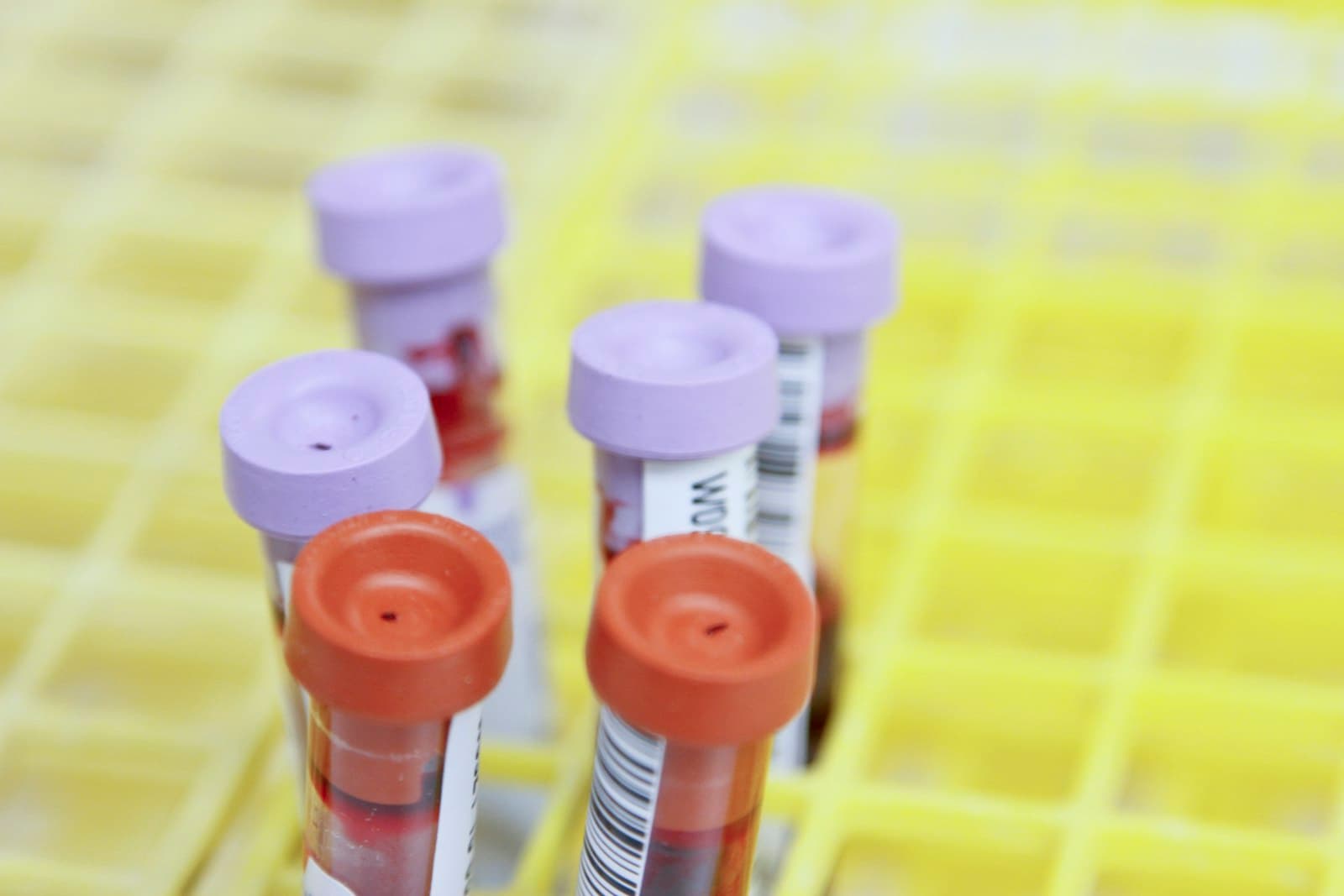 When a Family History Reveals More: A Thalassemia Carrier Screening Case Study